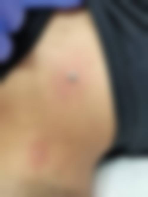 八、深圳美源医疗美容真实的患者评价