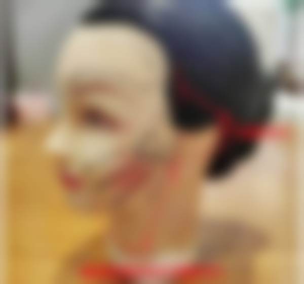 三、赵峰医生的技术特点