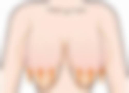 三、疤痕管理措施