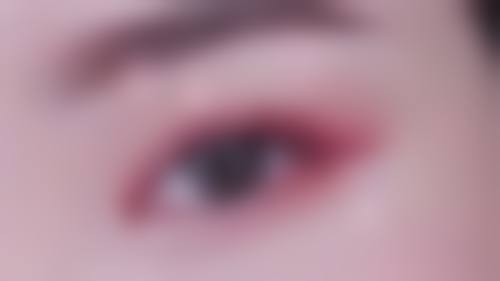 四、玻尿酸丰太阳穴的安心性和注意事项