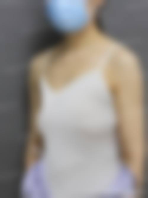 五、西安钻石恒美医疗美容医院价格表