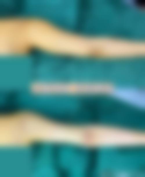 四、西安钻石恒美医疗美容医院特色项目