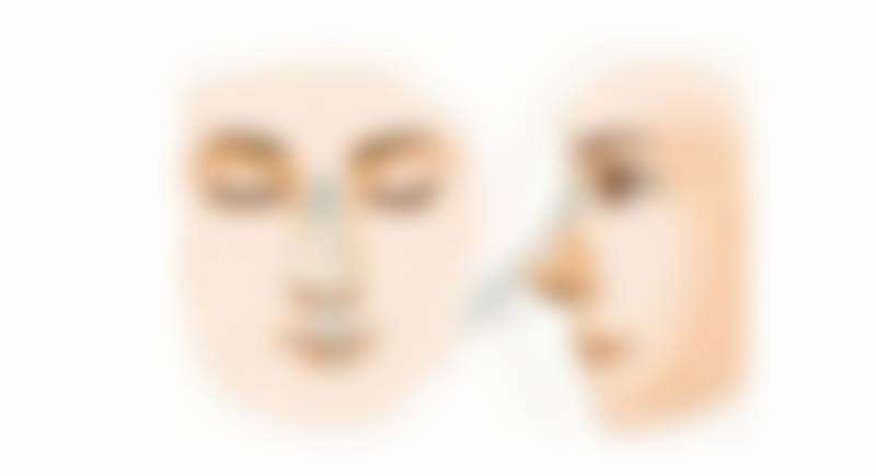 四、龚忠华医生手术实例展示