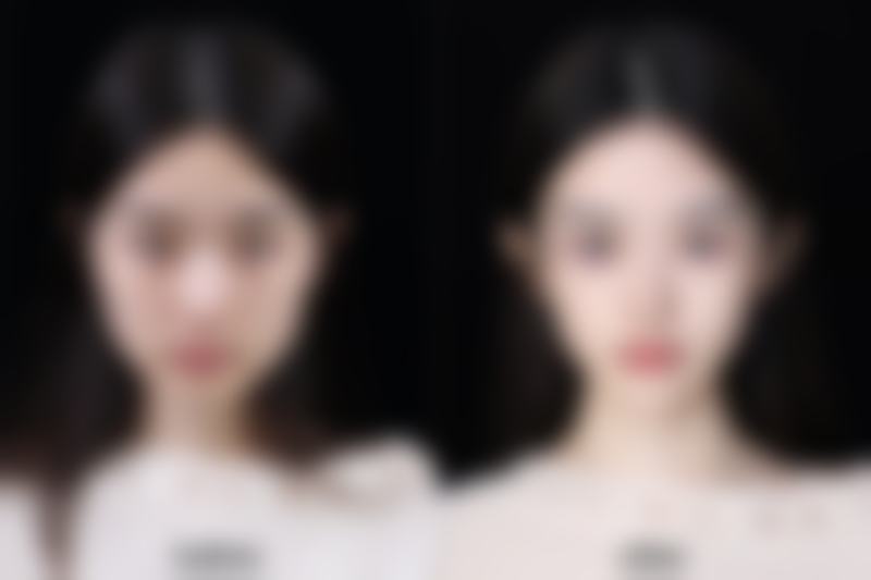 四、不同治疗方式对比