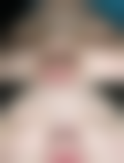 三、韩国 righthand 右手整形外科医院诊疗项目有哪些？