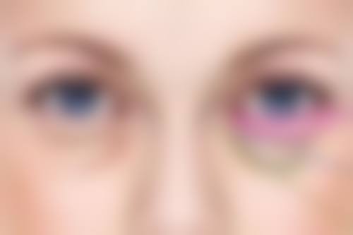 四、疤痕贴的正确使用方法