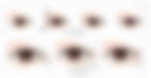 二、鼻子凹陷性疤痕的治疗方案选择