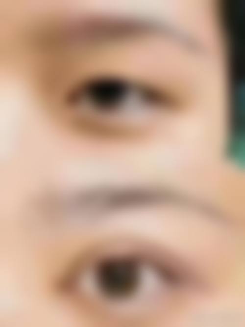 九、威海丁玉虎整形美容诊所真实的患者评价