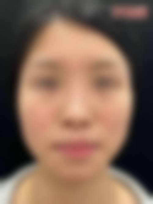 四、松滋颜美整形医院特色项目