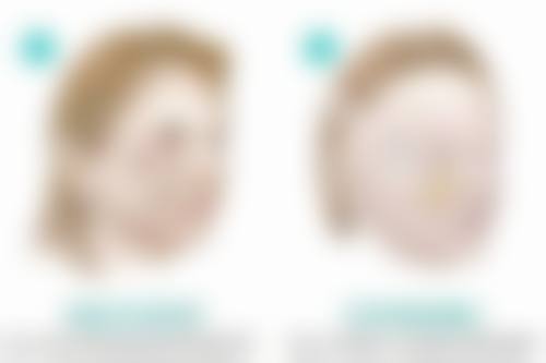 六、上海德琳医疗美容医院相俊医生男性增粗项目的服务体验