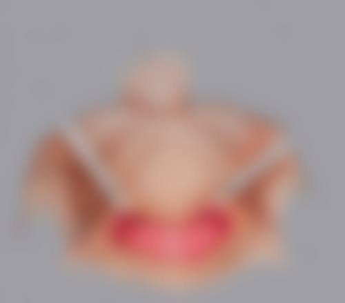 有必要做阴道紧缩术吗？总结来说