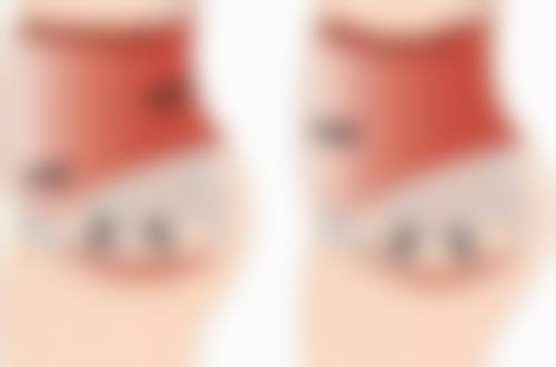 三、有必要做阴道紧缩术吗？还有这些替代方案