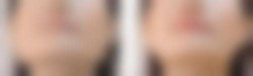 五、成都金荣医学美容诊所价格表