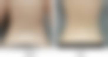 一、西安医疗美容外科(马平整形)正规吗?