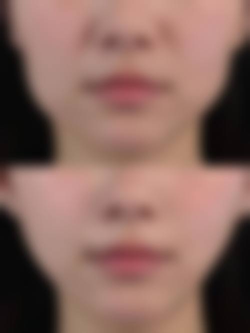 六、天津中怡医学美容门诊部价格表