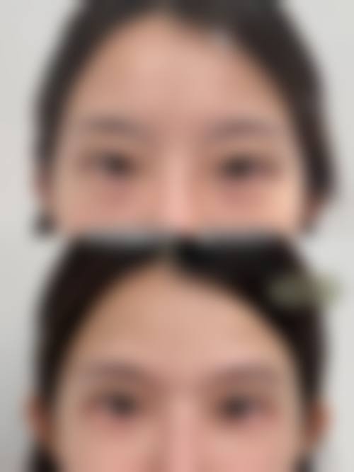 六、西安医疗美容外科(马平整形)价格表