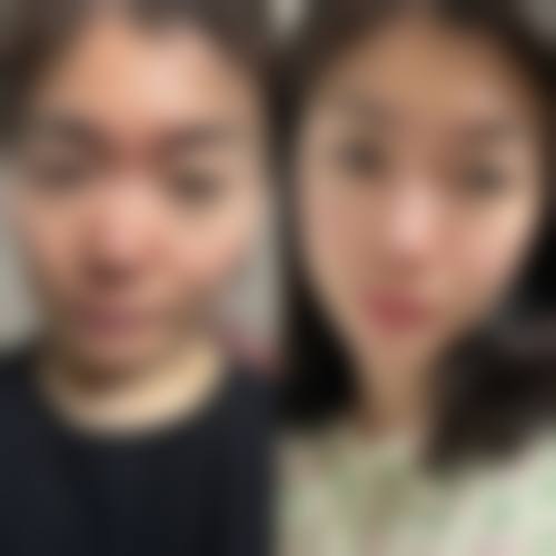 九、丽迪安真实的患者评价