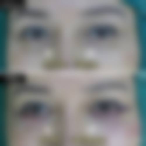 九、威海百颜医疗美容门诊部真实的患者评价