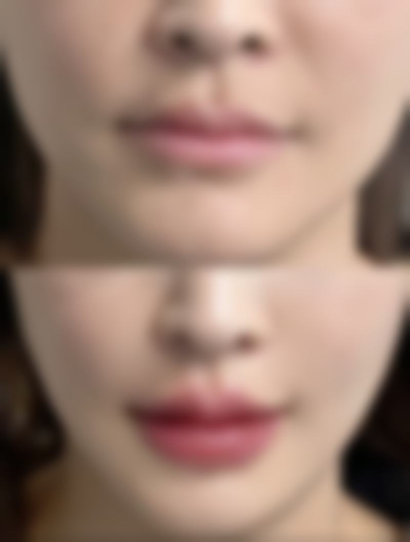 四、其他治疗方法