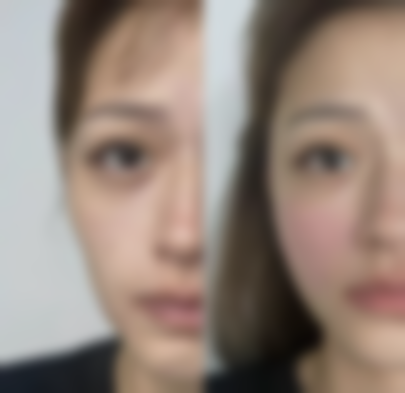 四、按摩的注意事项