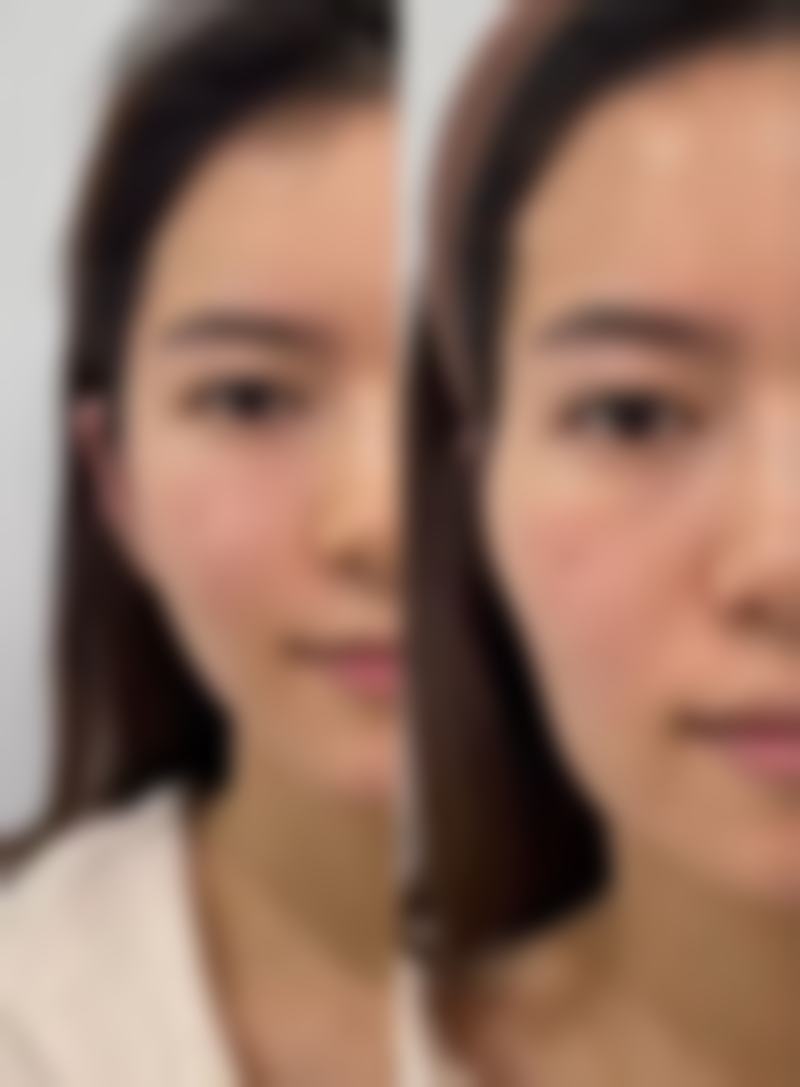 三、怎么按摩可以去掉眼袋和皱纹