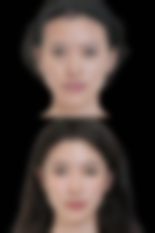 五、不同类型眼袋和皱纹的解决办法