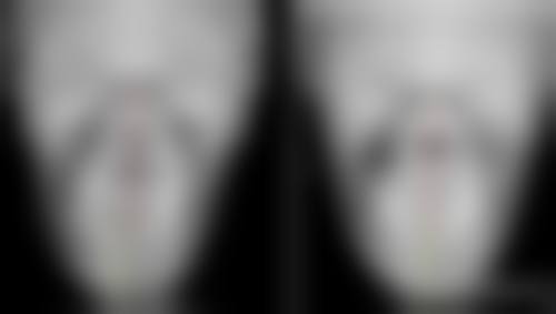 {种植的头发多久可以烫染？术后6个月至1年为宜，具体还需结合个人情况！ 