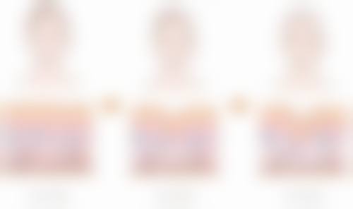 五、治疗老年人大眼袋的注意事项