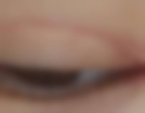 一、老年人大眼袋形成的原因