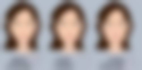 七、总结:疤痕增生可以通过手术去除吗