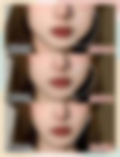 八、北京金莎整形美容医院真实的患者评价