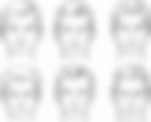 九、韩国instar整形医院真实的患者评价