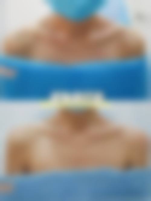 五、北京金莎整形美容医院价格表