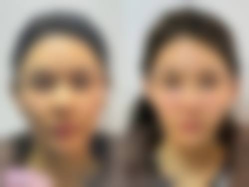 五、李世镛怎么预约?