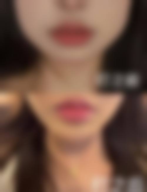 二、武汉美立方医疗美容怎么样?