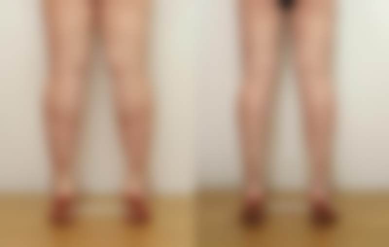 三、韩国sage医院特色项目