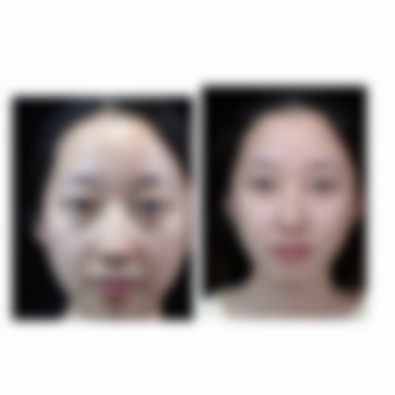 四、保山福惠皮肤美容诊所特色项目