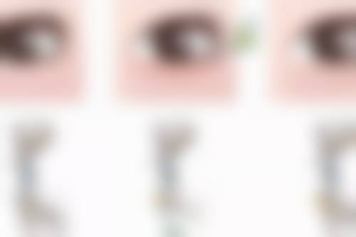 五、整形吸脂机构选择风险与注意事项