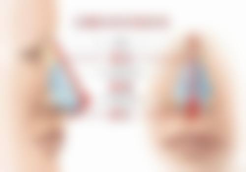 五、拉皮疤痕增生修复的其他情况