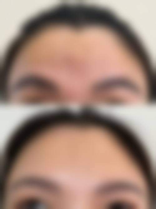 四、西安市第四 医院医疗美容科特色项目