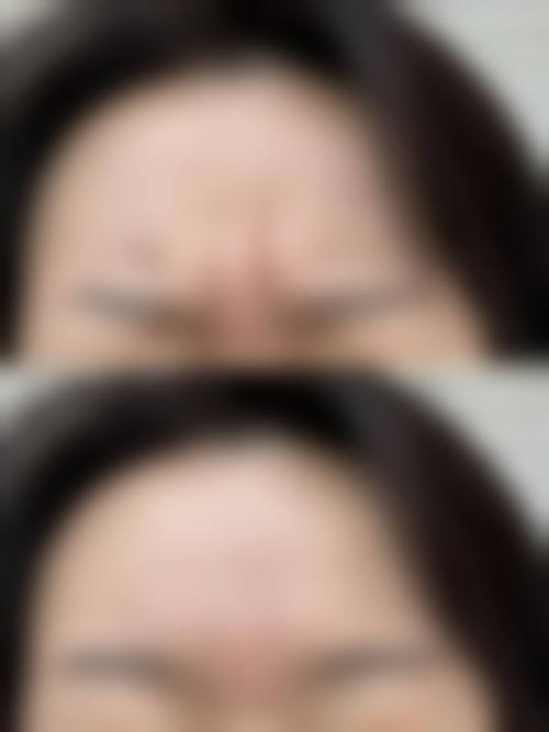 五、西安市第四 医院医疗美容科价格表