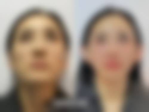 六、西安市第四 医院医疗美容科地址及交通