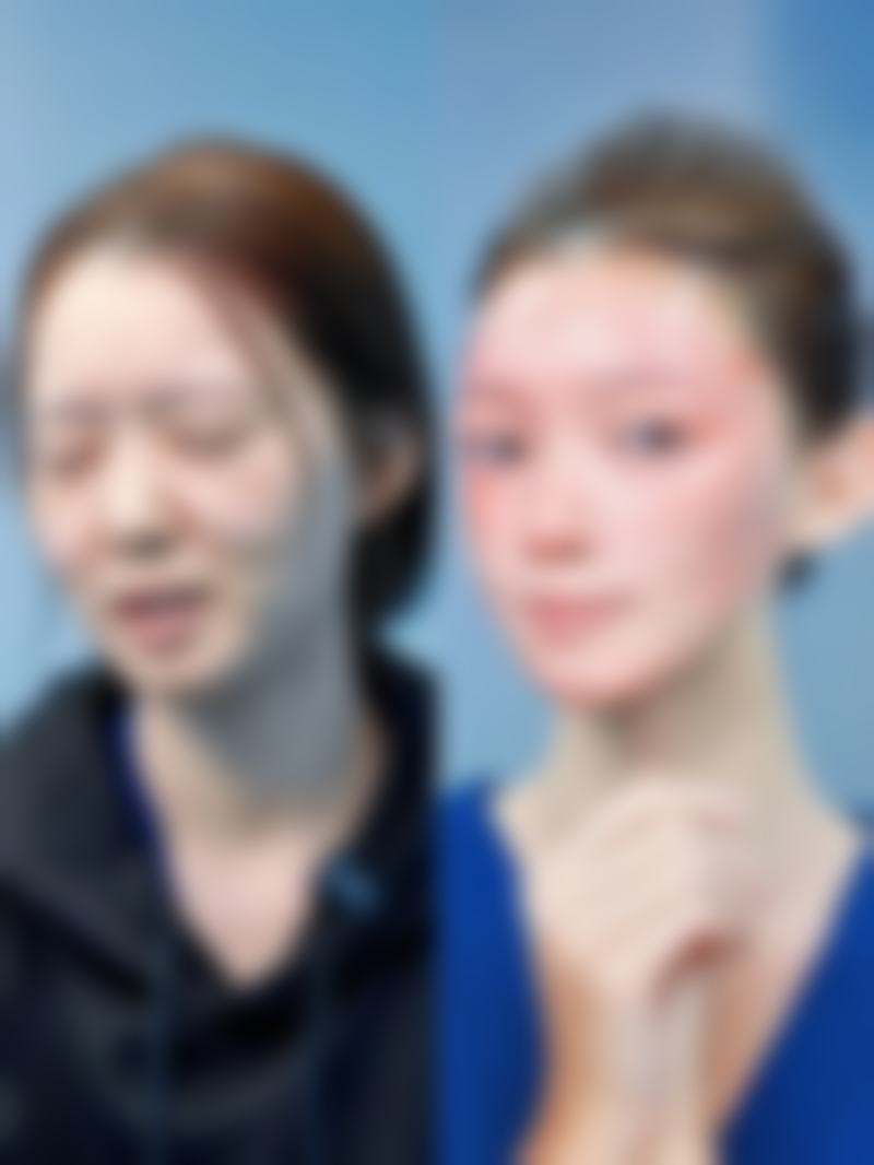 三、影响拉皮疤痕增生修复速度的因素