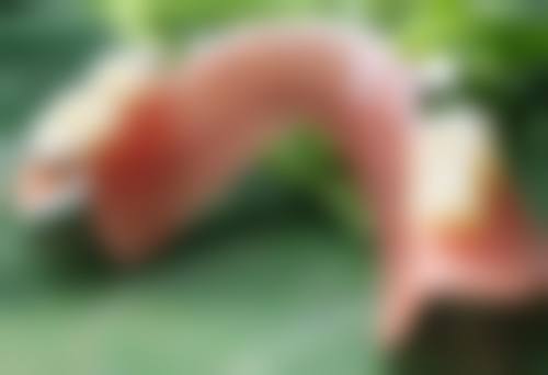 三、淡化疤痕增生黑色素沉淀的实用策略