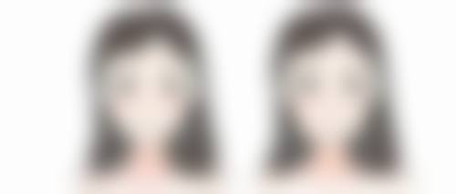 三、假体隆胸术后不同时间段的具体注意事项