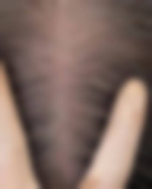 八、南京瑜雅医疗美容诊所真实的患者评价