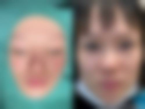 四、北京赫丽颜医疗美容诊所特色项目