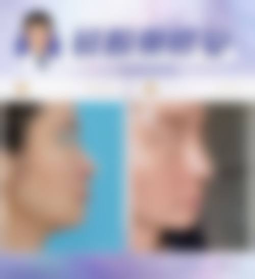 四、广州高尚医学美容中 心李翠华联系电话的查找方式