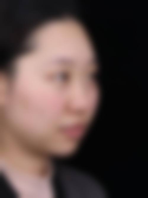 八、驻马店德医美医疗美容诊所真实的患者评价