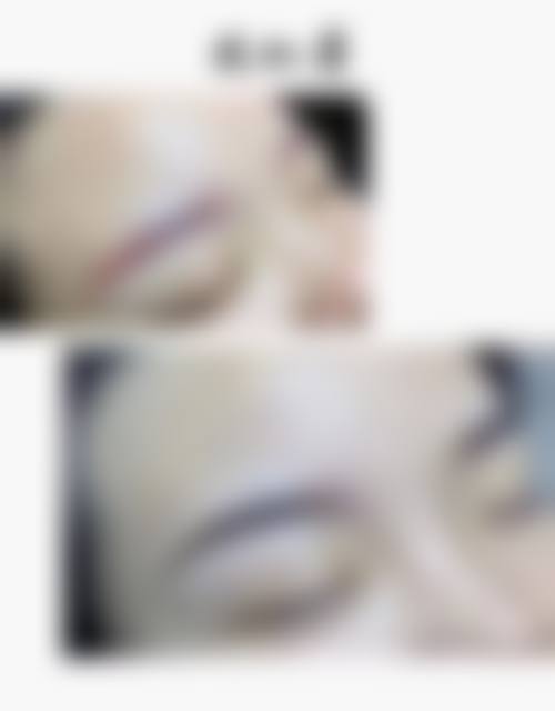 六、北京新美荟整形医院价格表